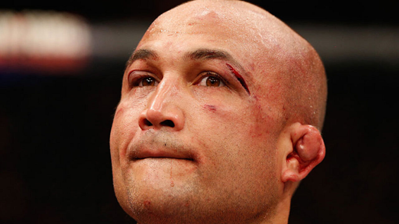bj penn cauliflower ears