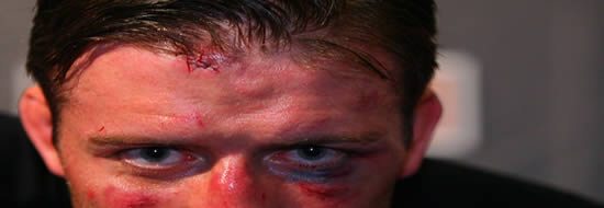 StephanBonnar550x190